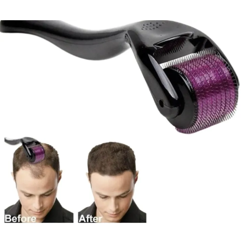 Derma Roller 540 Needles - Anti-Aging Skin Treatment Tool